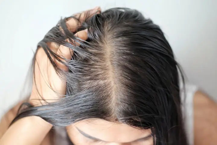 Tóc Hay Bị Bết Phải Làm Sao