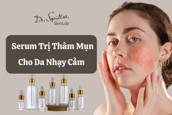 Toner Trị Thâm Mụn Cho Da Nhạy Cảm
