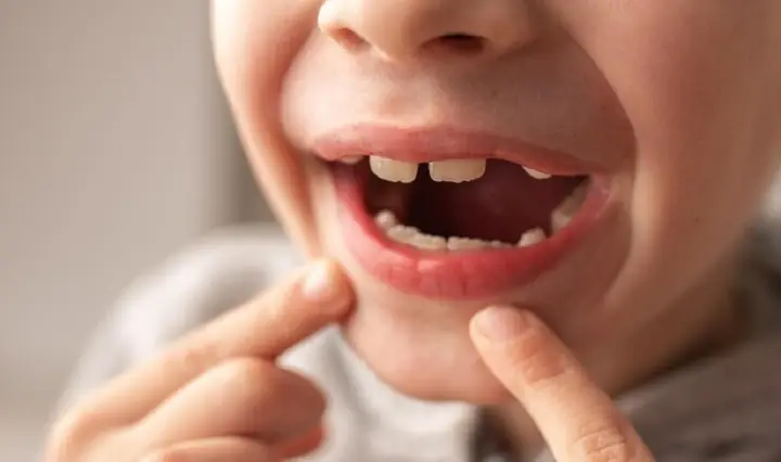 Trẻ 20 Tháng Tuổi Chưa Biết Nói Trẻ 20 Tháng Tuổi Chưa Biết Nói