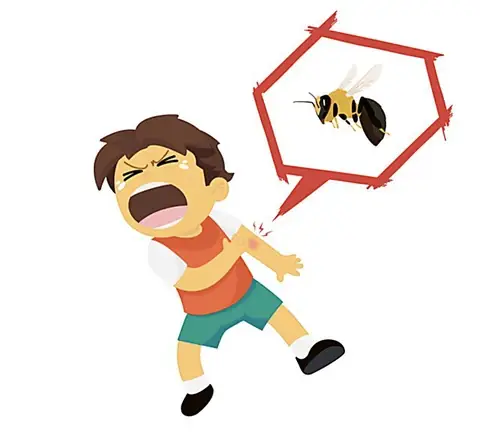 Trẻ Bị Ong Đốt Phát Sốt Trẻ Bị Ong Đốt Phát Sốt