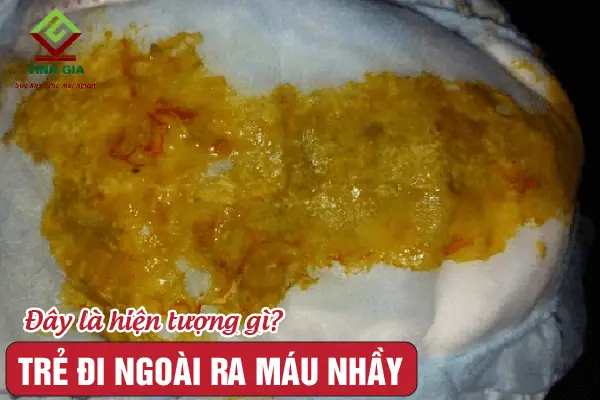 Trẻ Đi Ngoài Nhiều Lần Ra Máu Nhầy