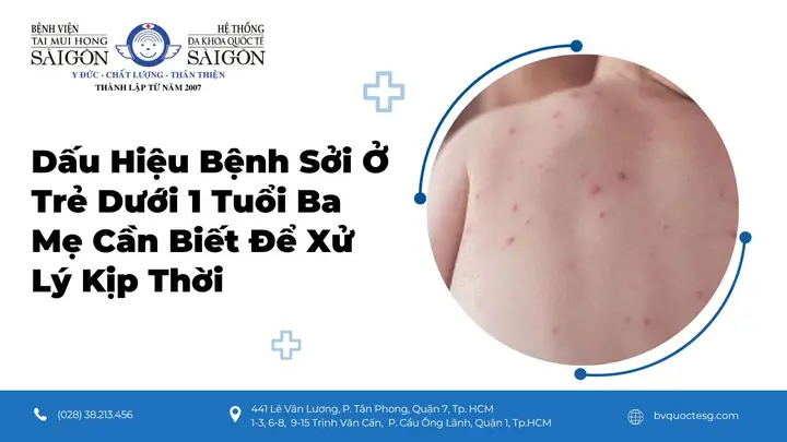 Trẻ Dưới 1 Tuổi Cần Bổ Sung Vitamin Gì