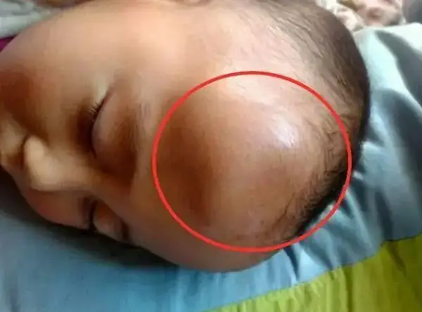 Tre Em Bi Nga Dap Dau Xuong Dat