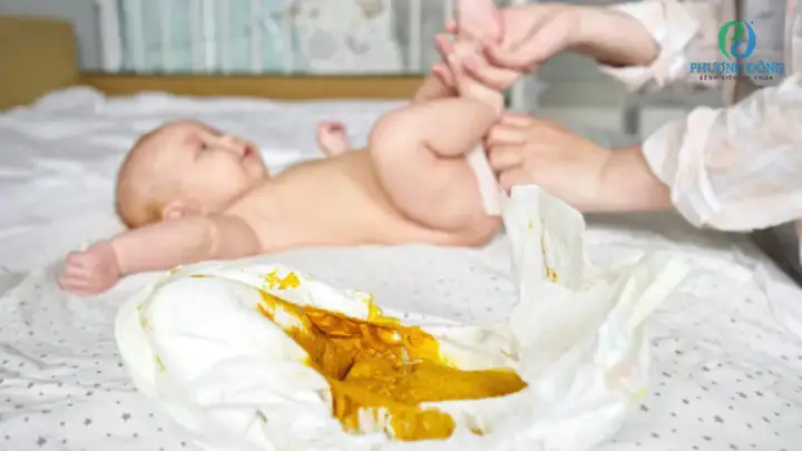 Trẻ Sơ Sinh Đi Ngoài Có Nước Trẻ Sơ Sinh Đi Ngoài Có Nước
