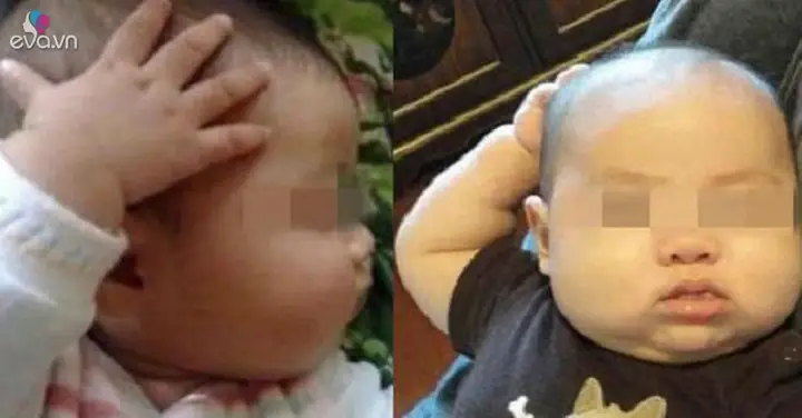 Trẻ Sơ Sinh Gãi Đầu Gãi Tai Trẻ Sơ Sinh Gãi Đầu Gãi Tai