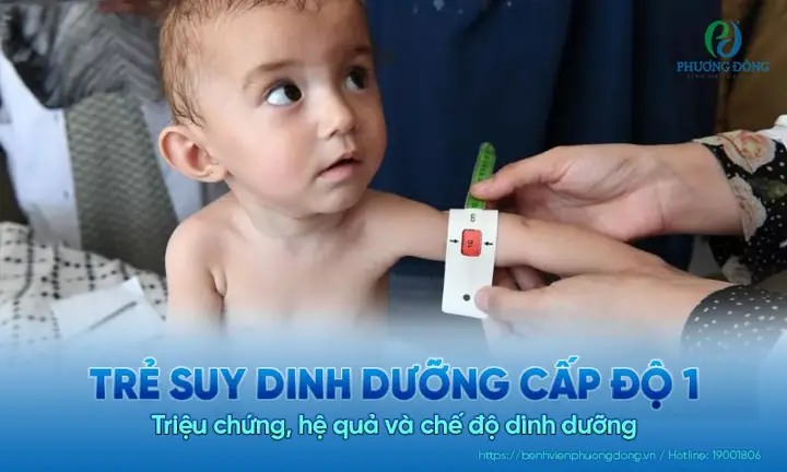 Trẻ Suy Dinh Dưỡng Cấp Độ 1