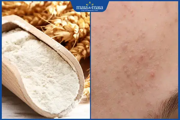 Trị Mụn Ẩn Dưới Da Bằng Bột Yến Mạch