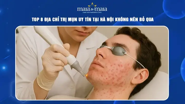 Trị Mụn Ở Đâu Tốt Nhất Hà Nội