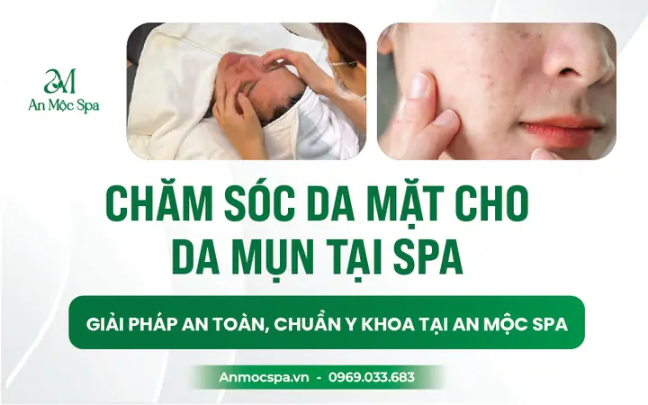 Trị Mụn Ở Đâu Tốt Nhất Hà Nội