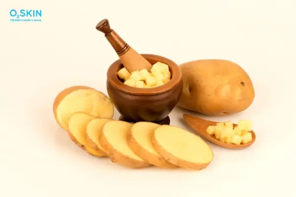 Trị Mụn Trứng Cá Bằng Khoai Tây