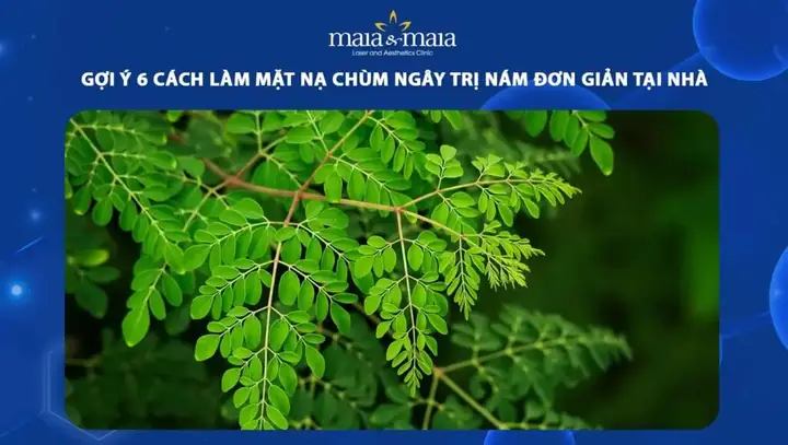 Trị Nám Bằng Cây Chùm Ngây