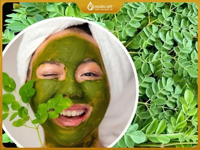 Trị Nám Bằng Cây Chùm Ngây