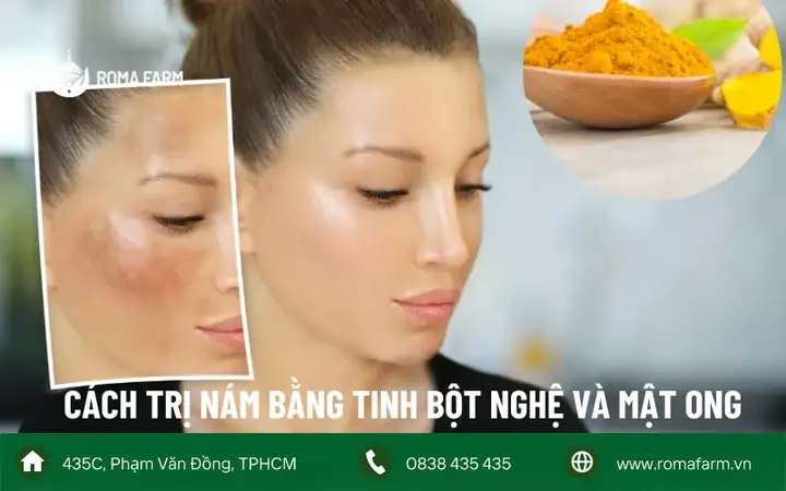 Trị Nám Bằng Mật Ong Và Nghệ