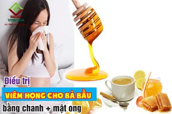 Trị Rát Họng Cho Bà Bầu