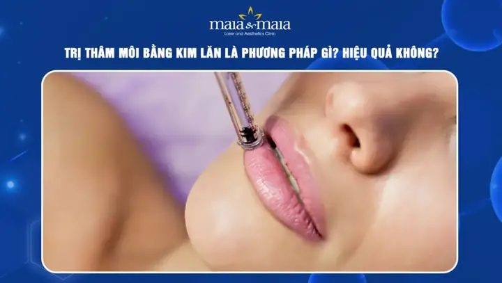 Trị Thâm Môi Lip Light Có Tốt Không