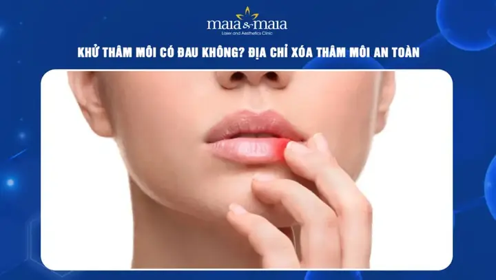 Trị Thâm Môi Lip Light Có Tốt Không