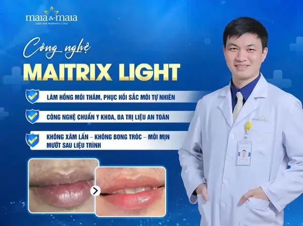 Trị Thâm Môi Lip Light Có Tốt Không