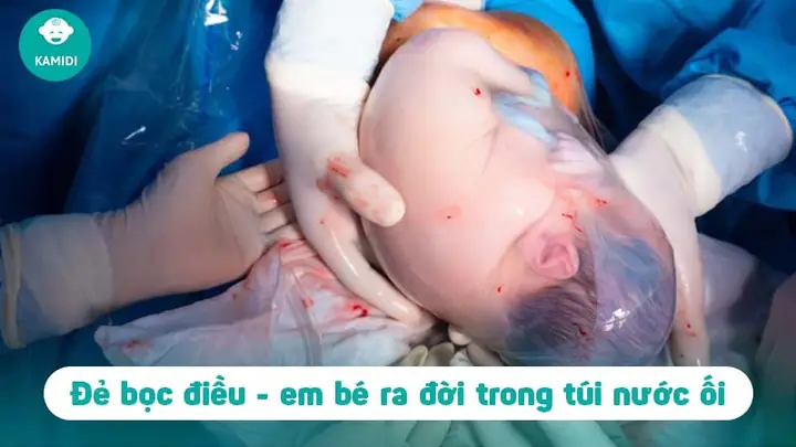 Vận Mệnh Người Sinh Bọc Điều