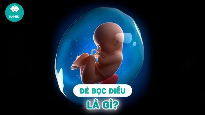 Vận Mệnh Người Sinh Bọc Điều