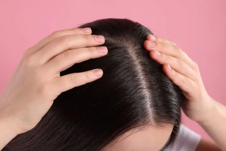 Vừa Gội Đầu Xong Da Có Gàu