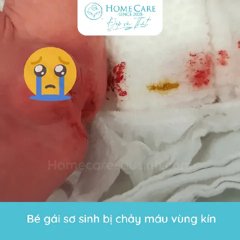 Vùng Kín Be Gái Sơ Sinh Có Mùi Hôi