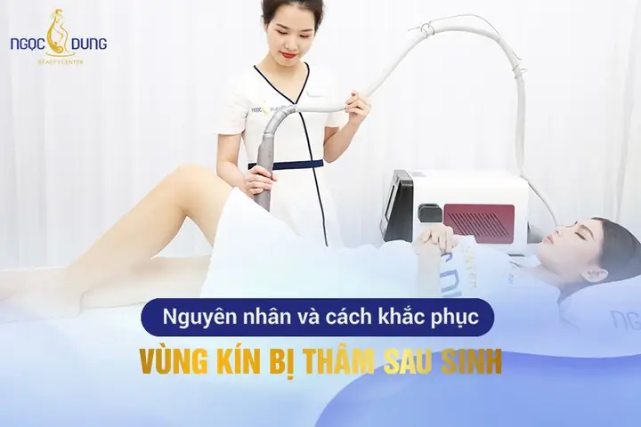 Vùng Kín Bị Thâm Sau Sinh