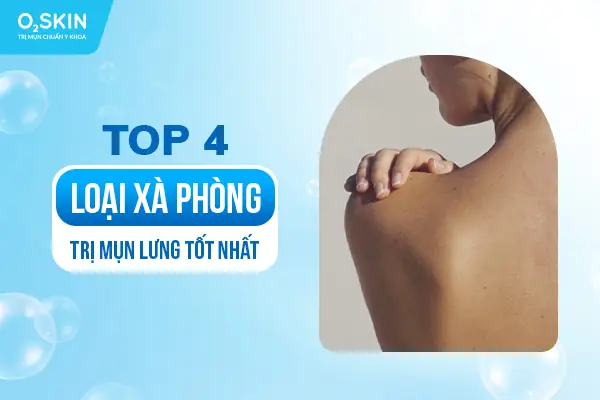 Xà Phòng Trị Mụn Thâm Lưng Xà Phòng Trị Mụn Thâm Lưng