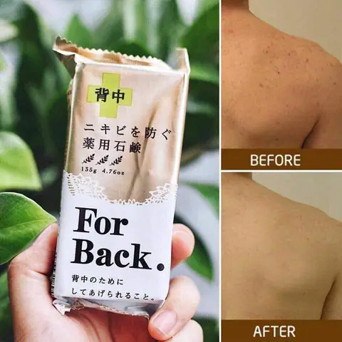 Xà Phòng Trị Mụn Thâm Lưng Xà Phòng Trị Mụn Thâm Lưng
