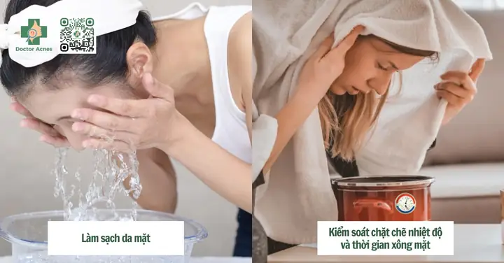 Xông Mặt Trị Mụn Trứng Cá